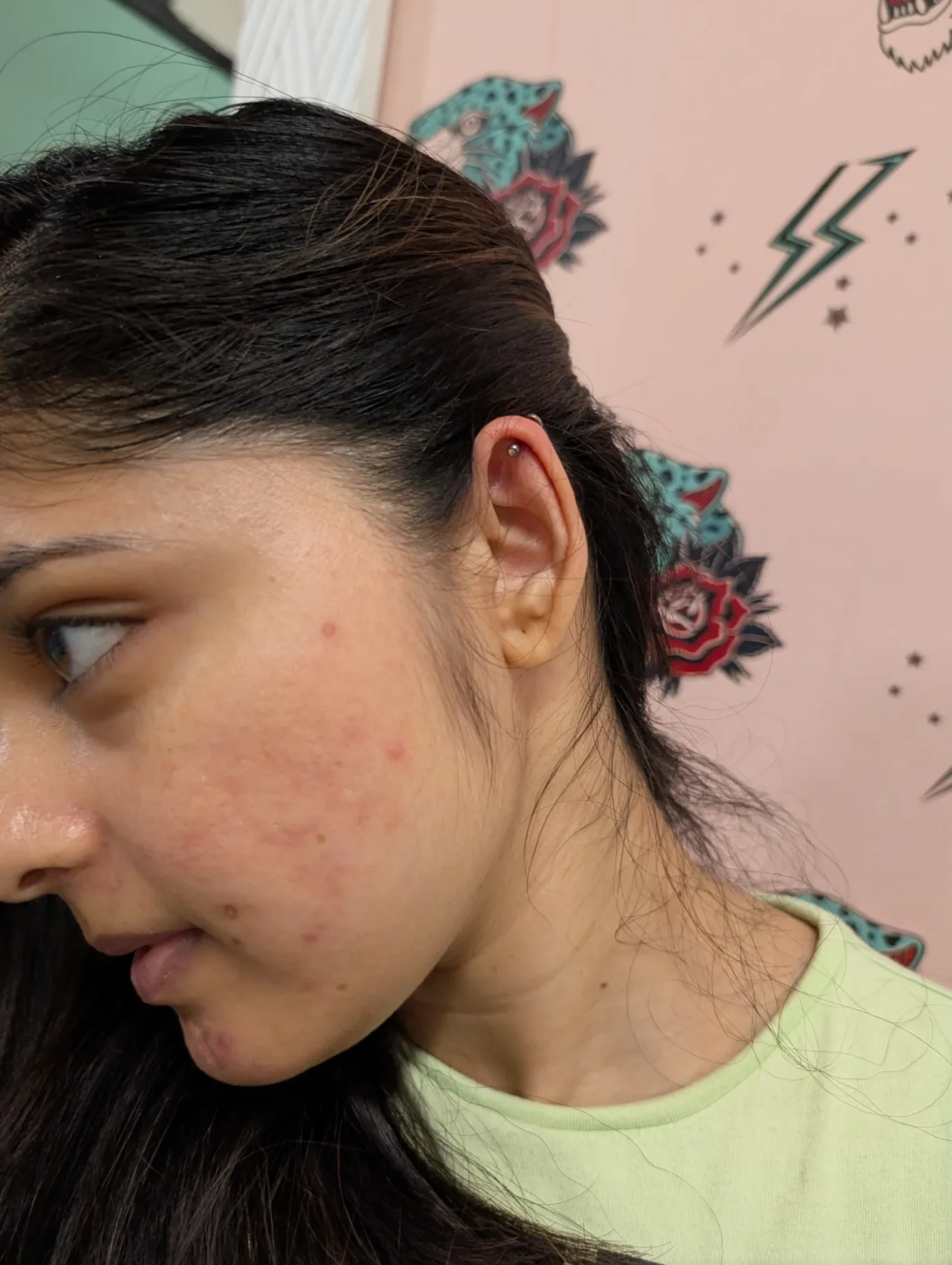 Upper Helix Piercing