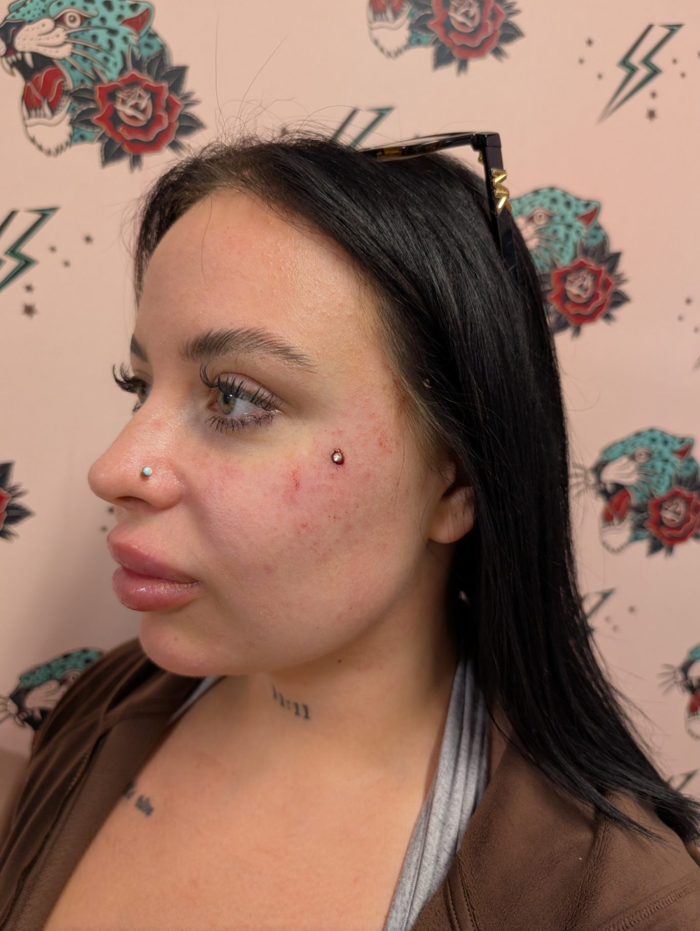 Facial Microdermal piercing