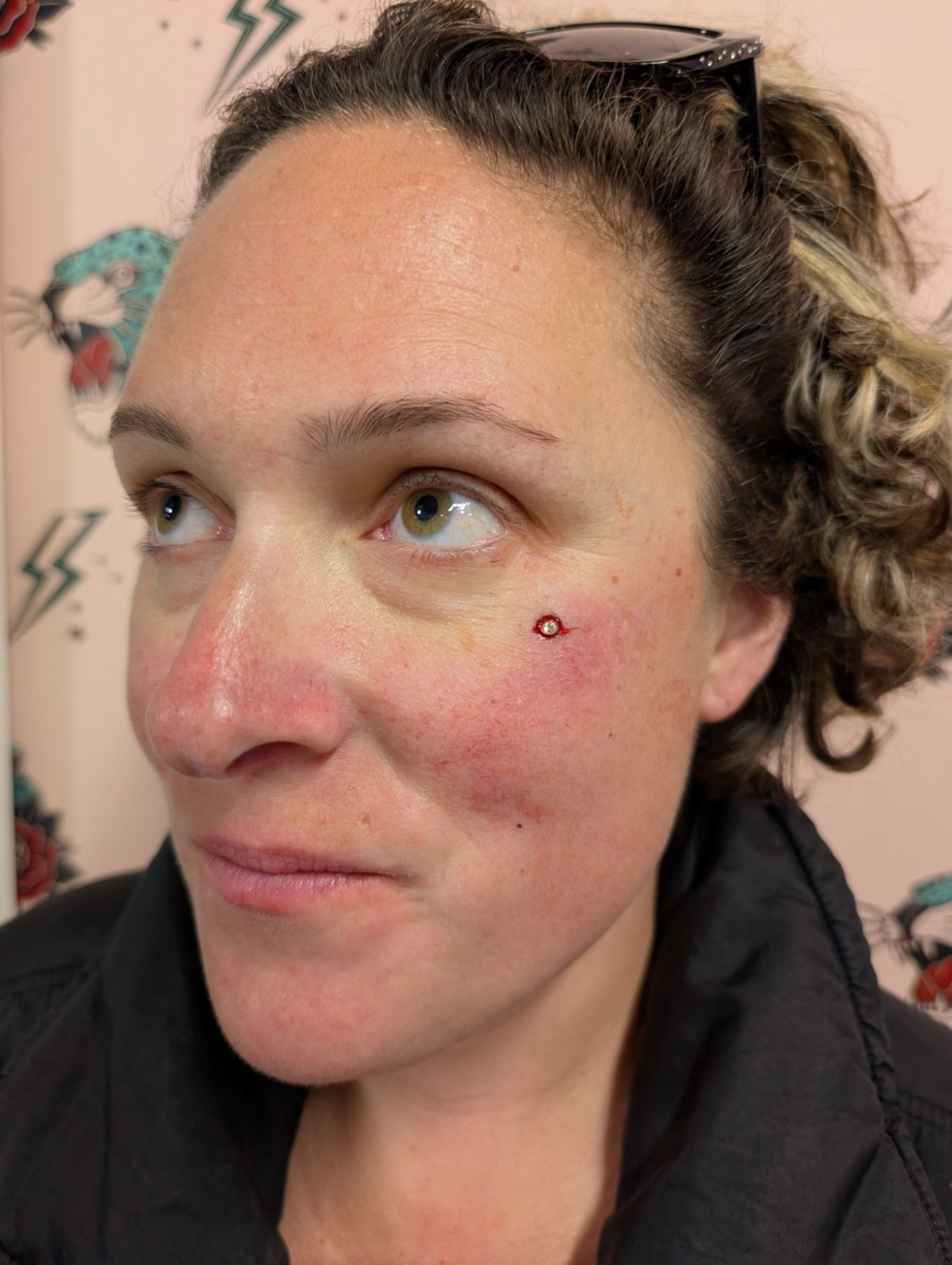 Facial Microdermal piercing