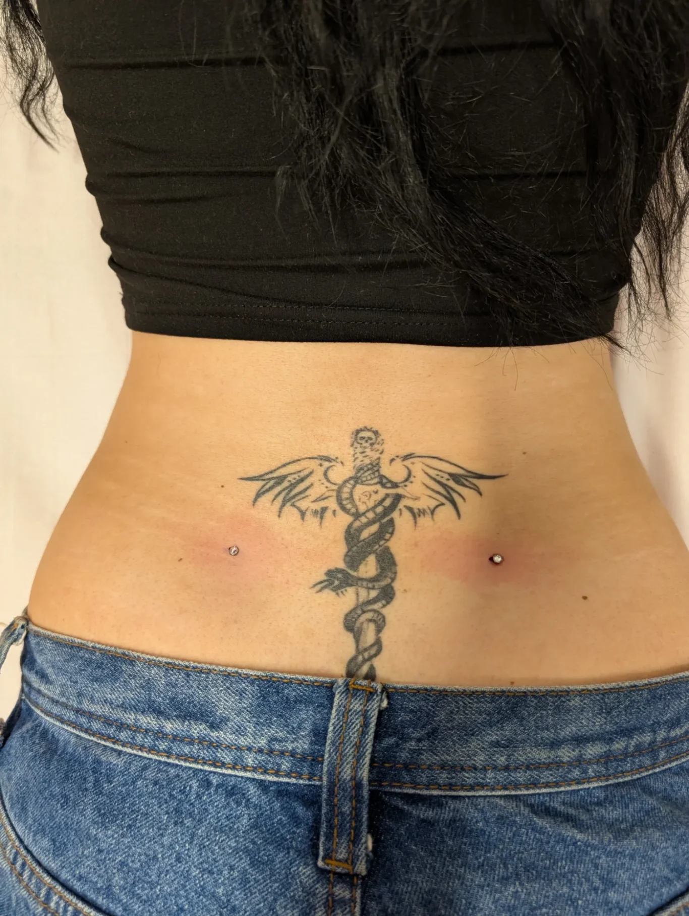 Back Microdermals