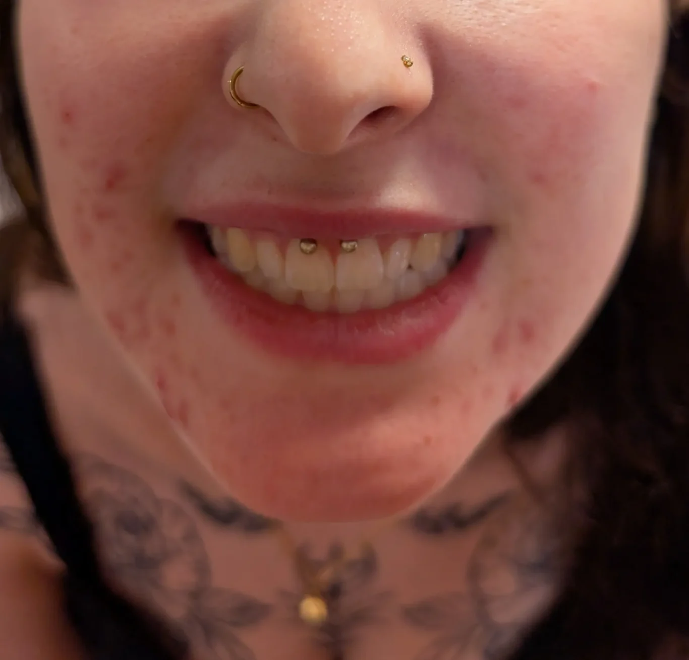 Smiley Piercing