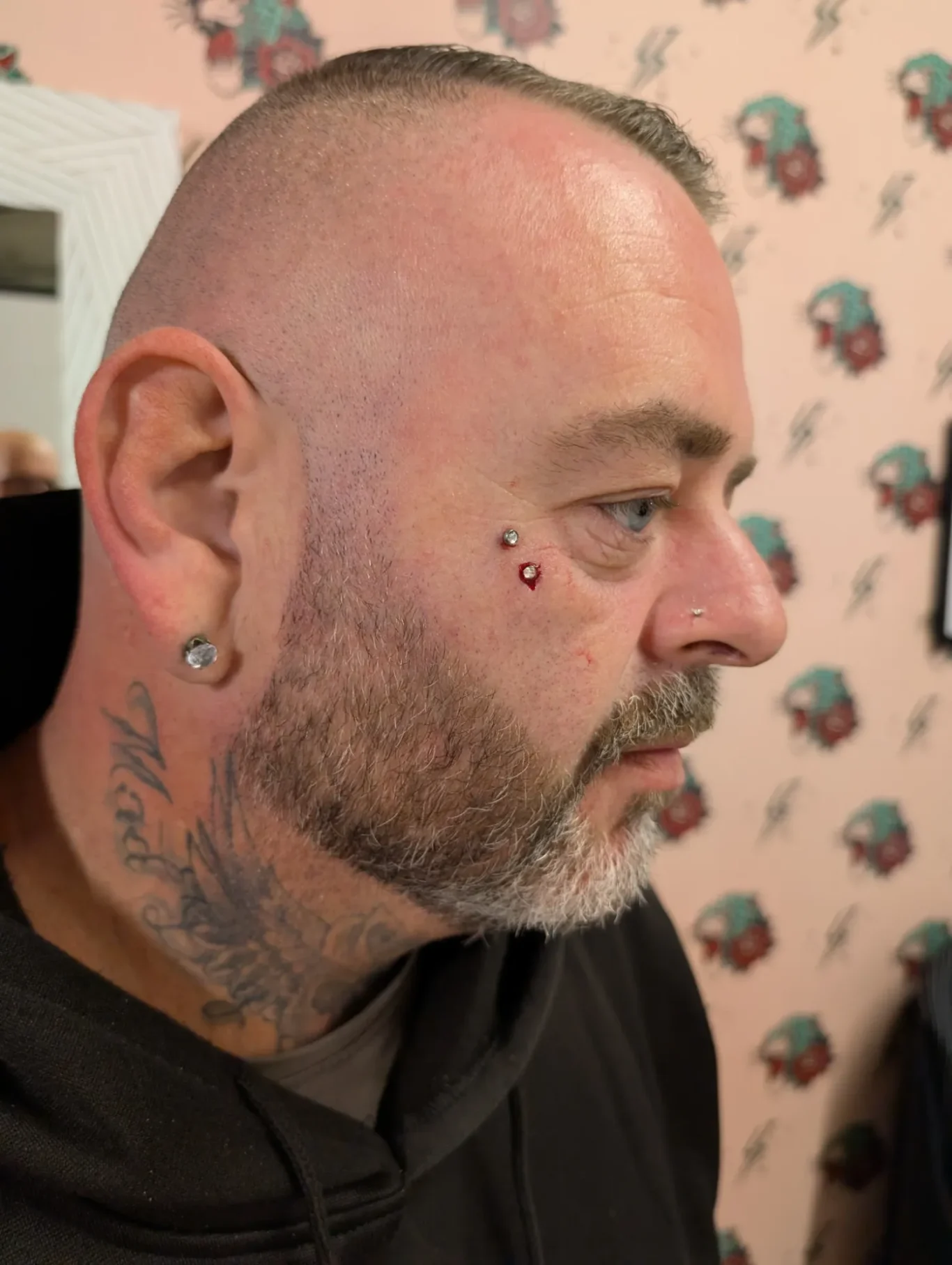 Facial Microdermal piercings