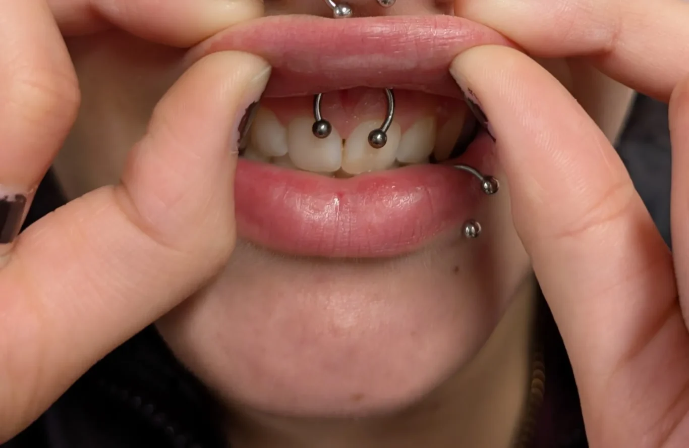 Smiley Piercing