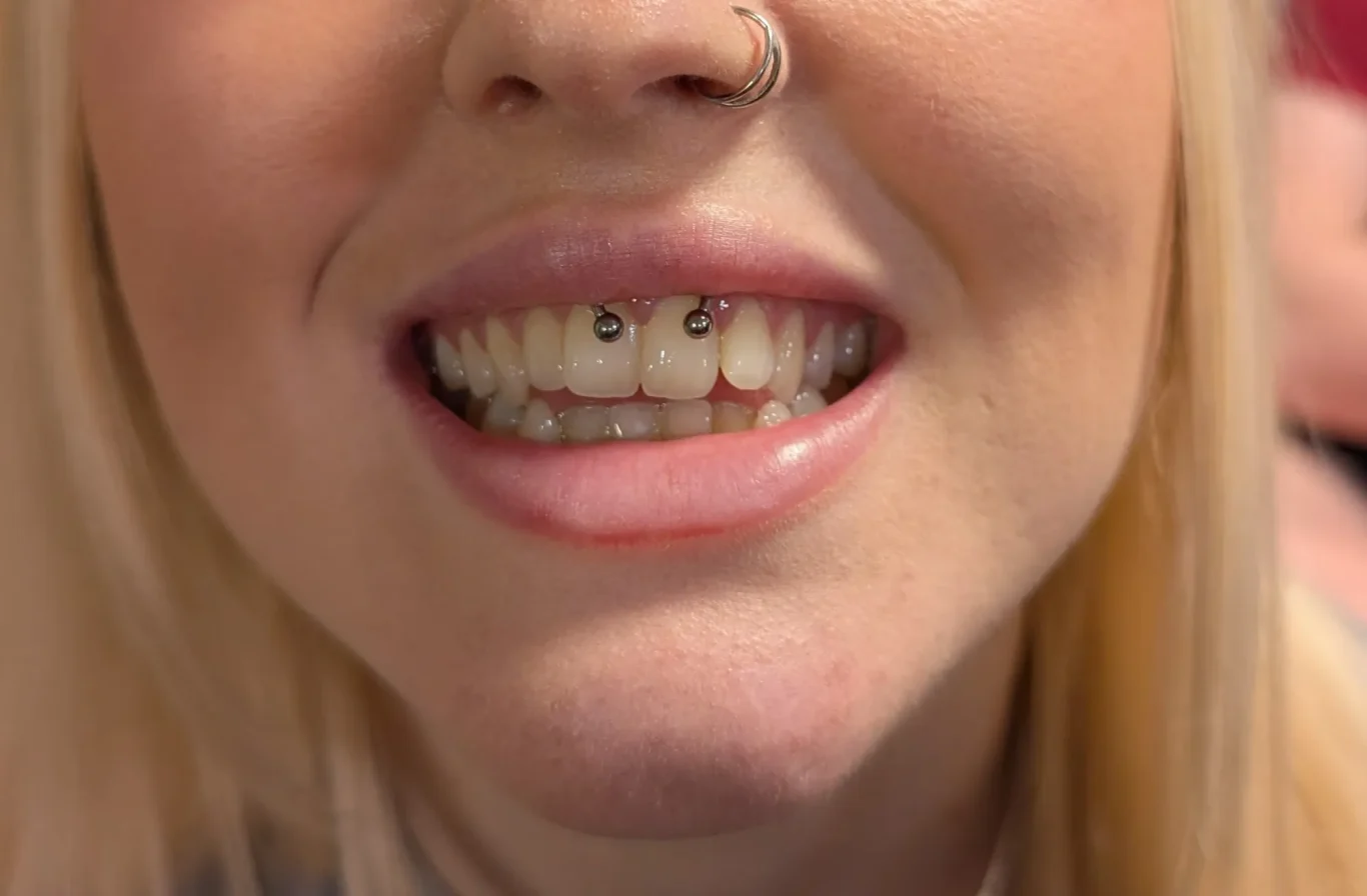 Smiley Piercing